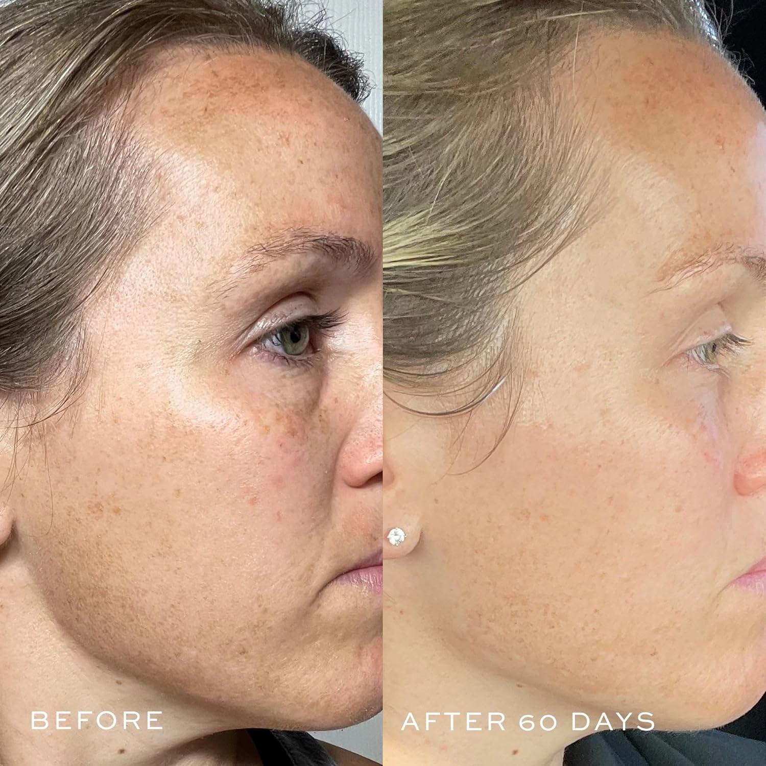 image:imageDIME Beauty TBT Serum AntiAging Face Serum with Bakuchiol Niacinamide and Mandelic Acid Retinol Alternative for Fine Lines and Wrinkles Vegan CrueltyFree 1 oz 30 ml